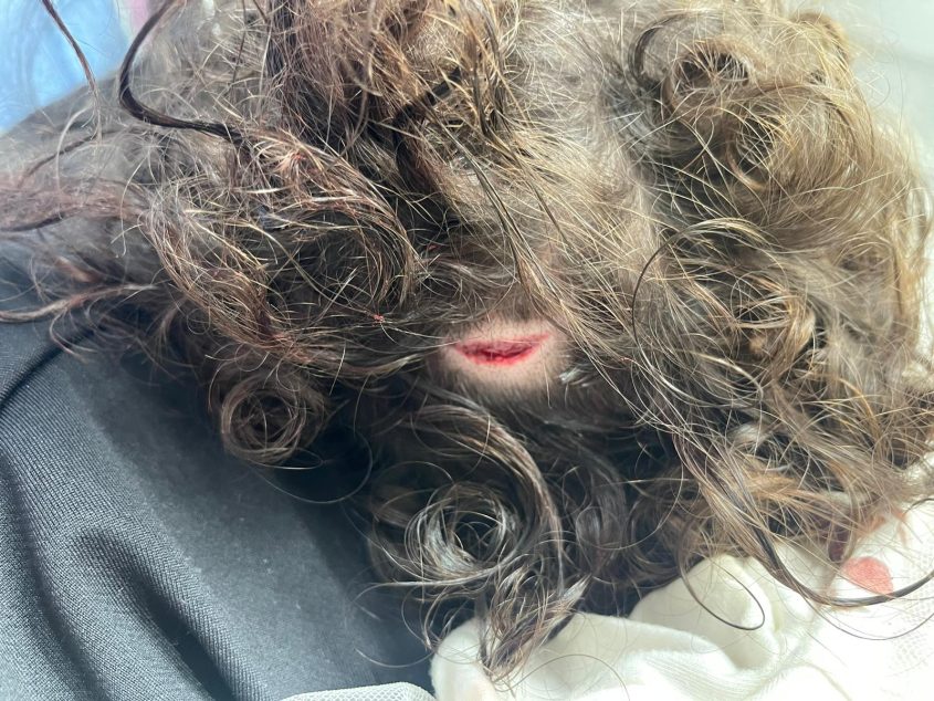הפתח שנגרם בראשה של הילדה