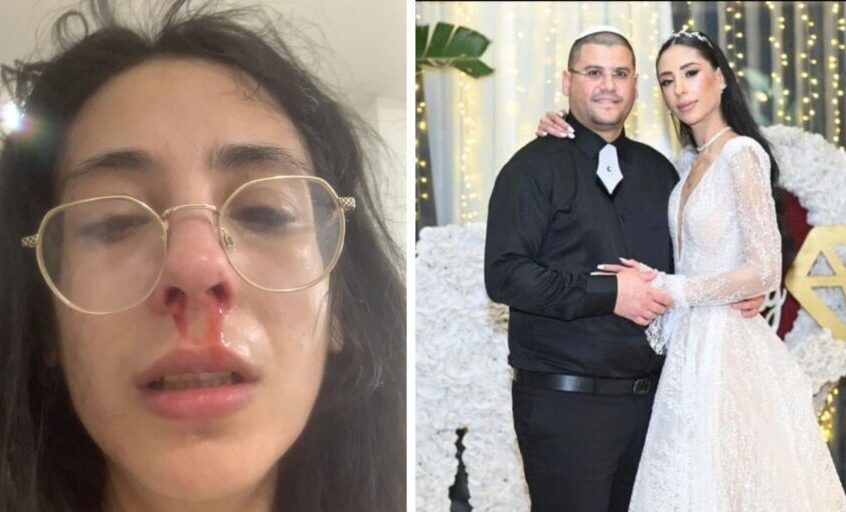 טל ומשה אלקירי ביום חתונתם, לצד תיעוד החבלות בעקבות תקיפתו