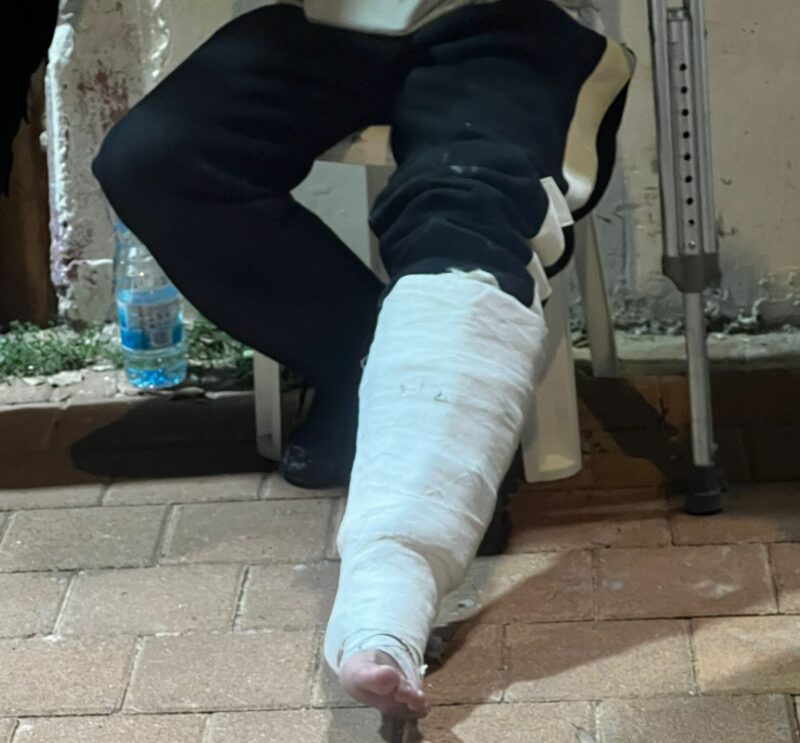 הגבס של הצעיר מאשקלון. צילום: דוברות המשטרה